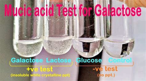 Mucic acid test .